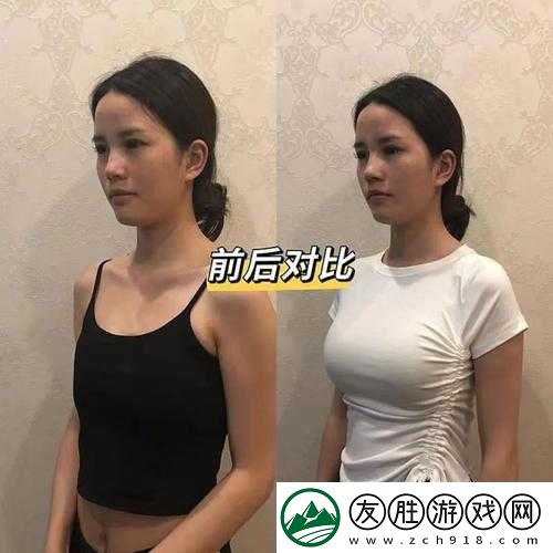 水滴形與圓形豐胸對(duì)比：哪種更適合你的美胸追求